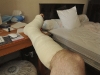 134_AnklePics